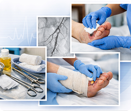 Home-Based Wound Care