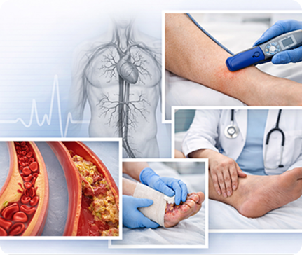 Home-Based Wound Care
